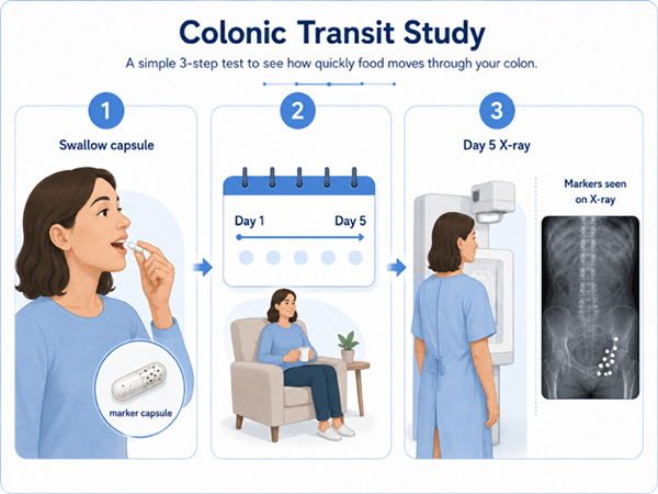 Colonic transit study in Dubai showing marker capsule, day 5 X-ray and retained markers in the colon