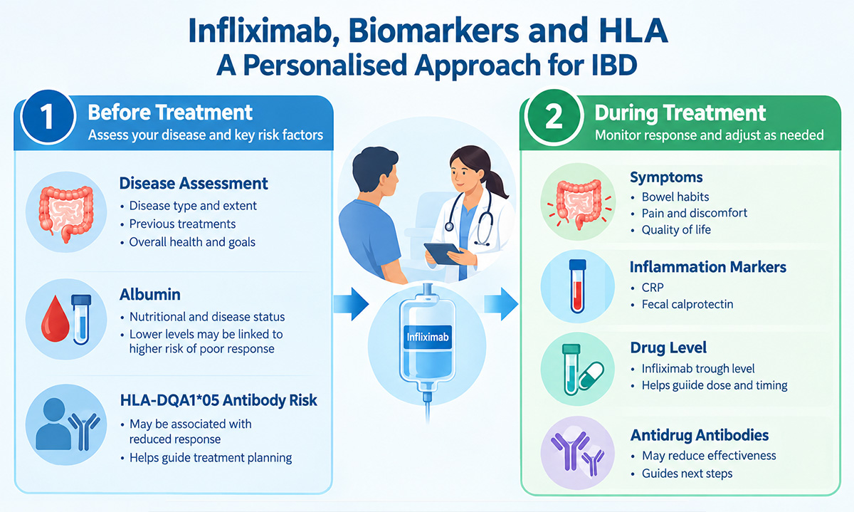 Clinical tests, HLA-DQA1*05 antibody risk and emerging biomarkers informing infliximab decisions
